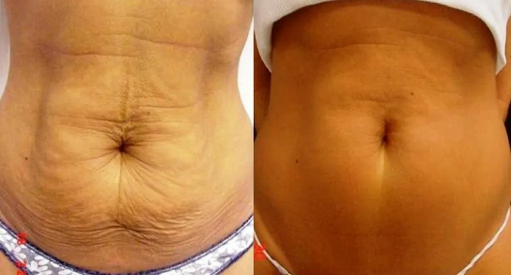 how to tighten loose skin 4 How To Tighten Your Skin Naturally. • FaithPanda