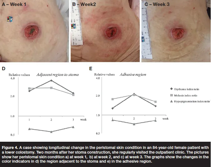 skin color analyzer 6