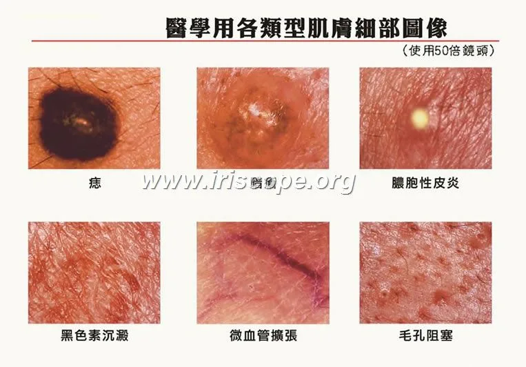 skin color analyzer 9