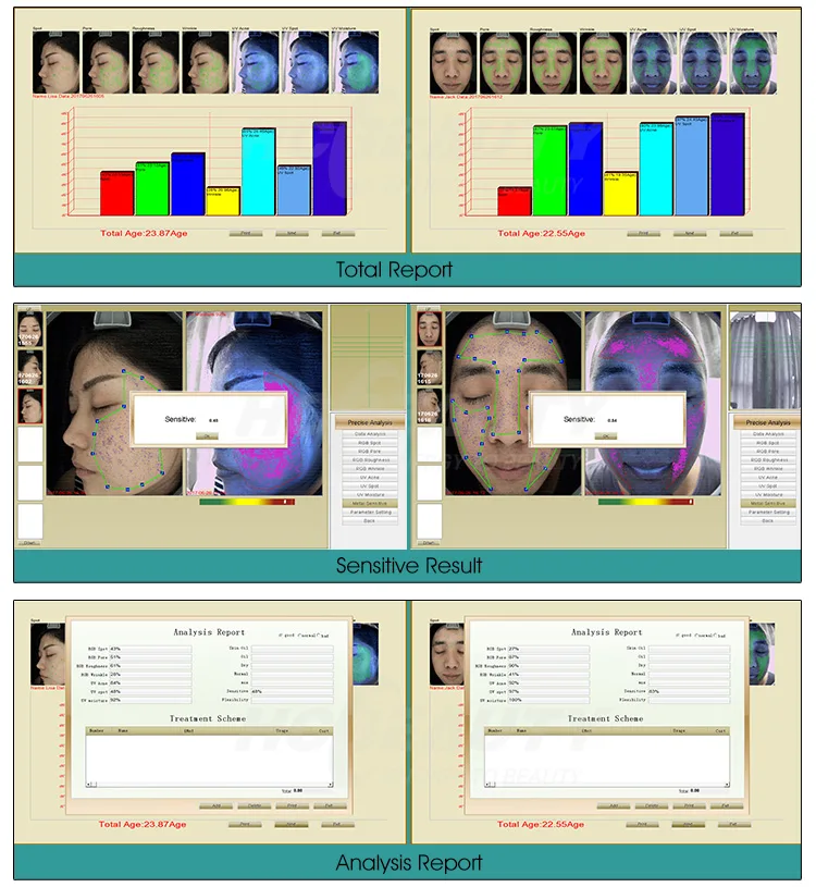 What is facial skin analyzer? 6 facial skin analyzer 4
