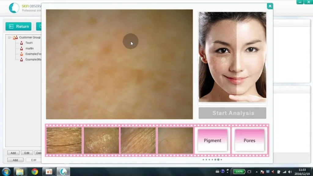 Best proderm skin analyzer for Skin Analyzer 7 skin analyzer machine manufacturers
