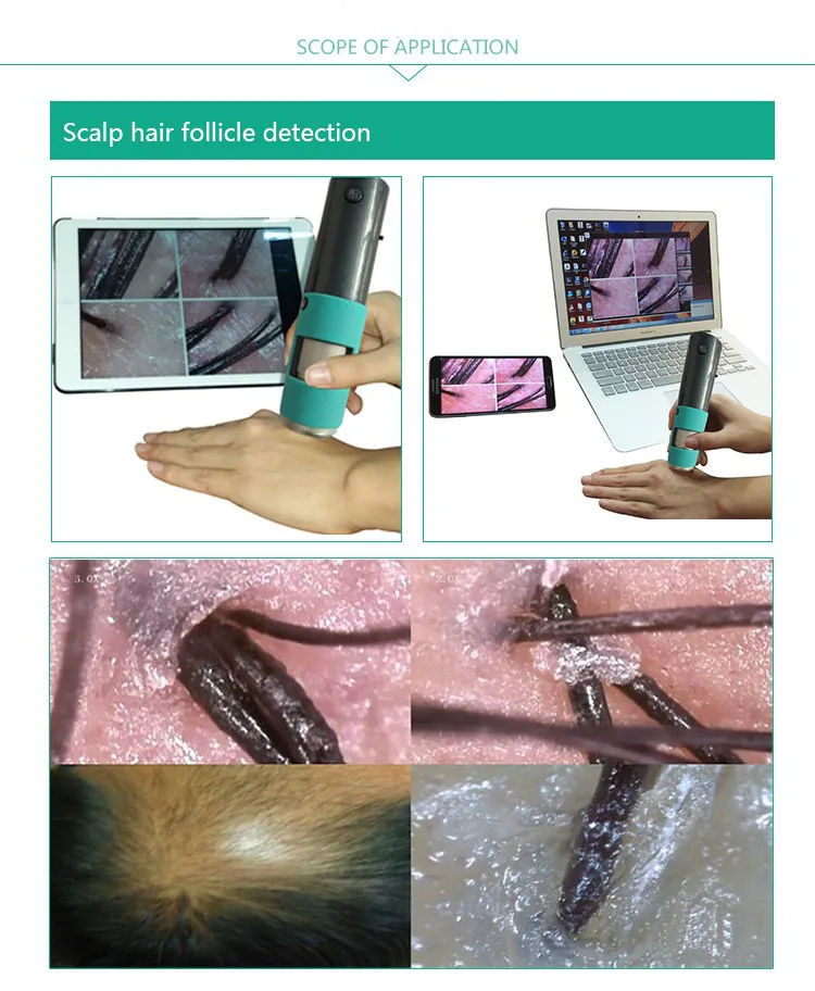 skin analyzer magnifier Here’s a Quick Way to know 5 kin analyzer magnifier