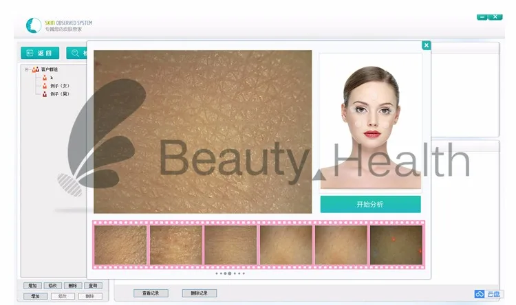 Best proderm skin analyzer for Skin Analyzer 3 proderm skin analyzer
