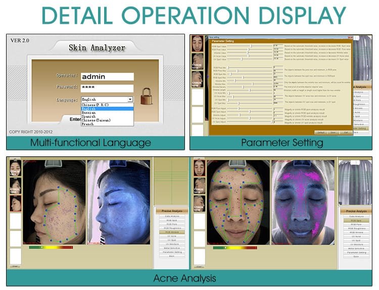 facial skin analyzer 3
