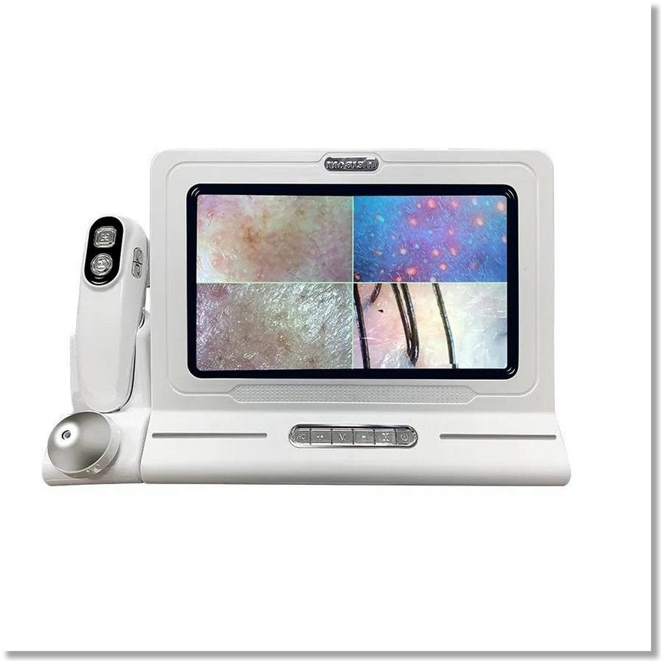 hair and skin analyzer