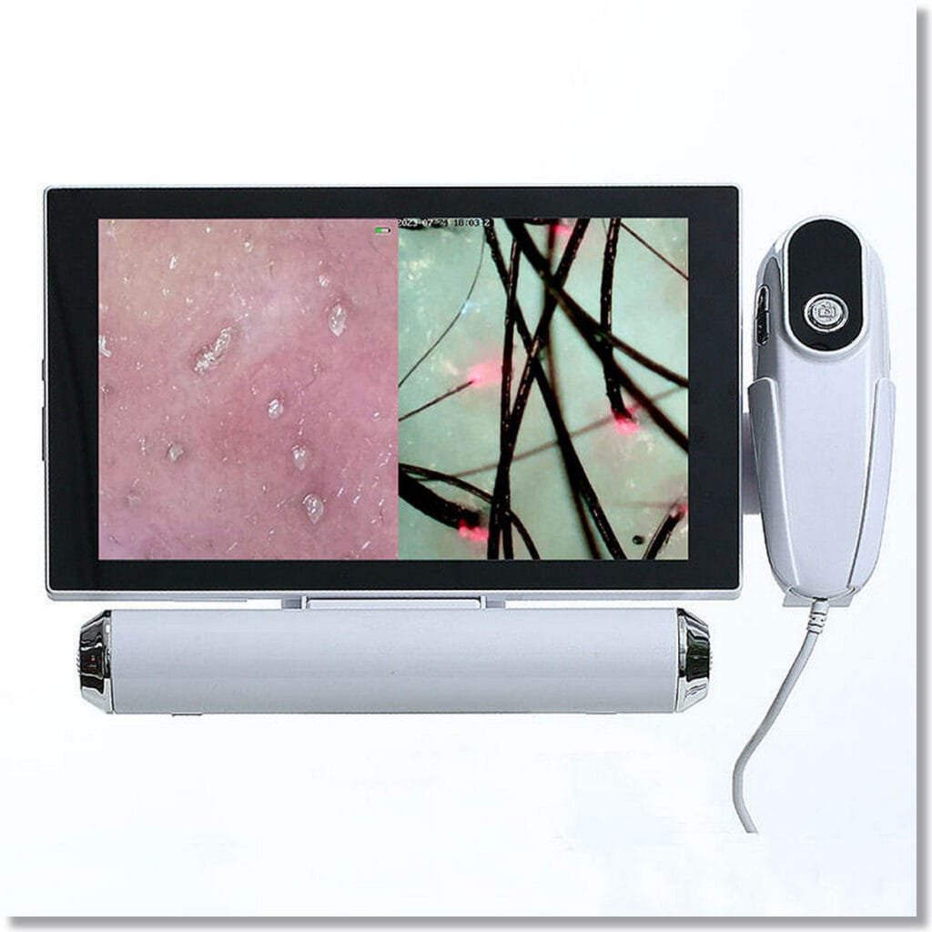 Maikong Hair and Skin Analyzer: The Complete Guide to Technology, Benefits, and Applications 5 hair and skin analyzer